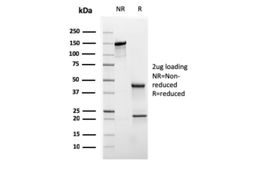 SDS-PAGE - Anti-Cytokeratin 20 Antibody [KRT20/3145] (A249674) - Antibodies.com