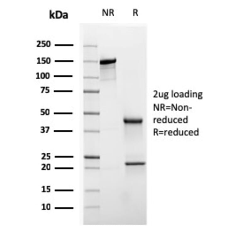 SDS-PAGE - Anti-Cytokeratin 20 Antibody [KRT20/3145] (A249674) - Antibodies.com