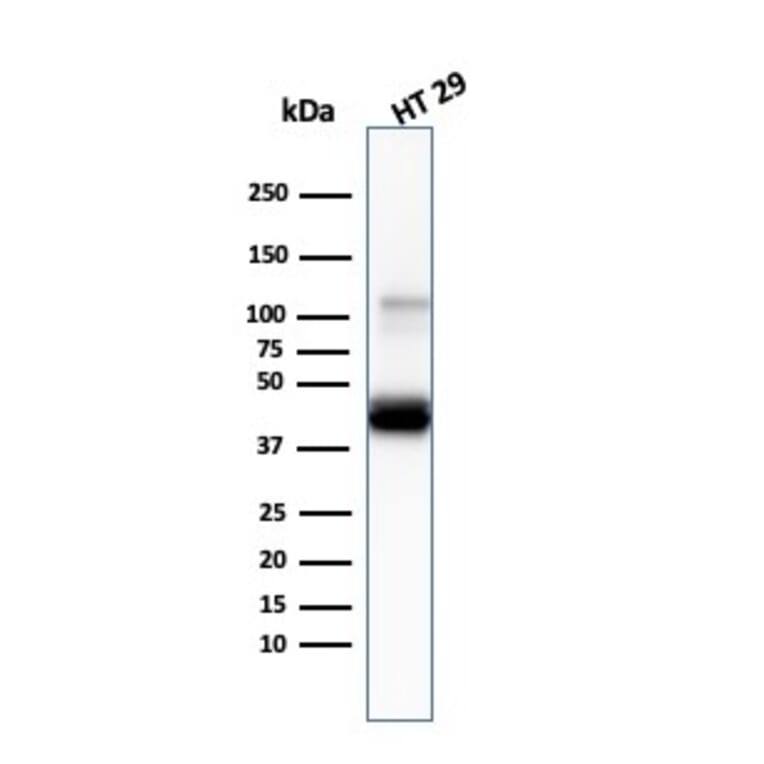 Western Blot - Anti-Cytokeratin 20 Antibody [KRT20/3145] (A249674) - Antibodies.com