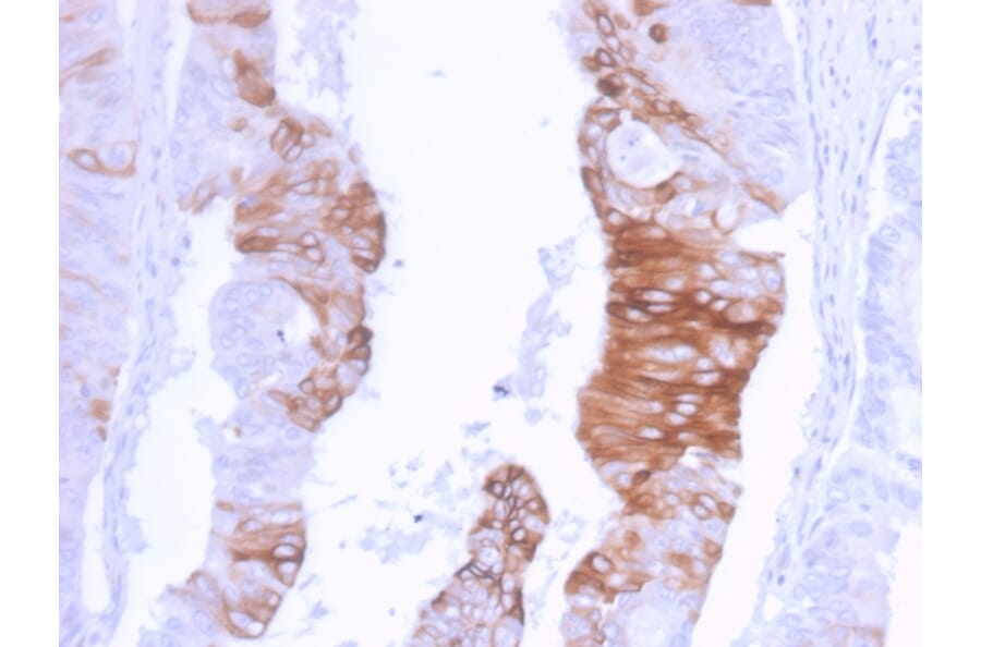Immunohistochemistry - Anti-Cytokeratin 20 Antibody [KRT20/3129R] (A249674) - Antibodies.com
