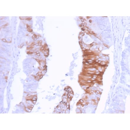 Immunohistochemistry - Anti-Cytokeratin 20 Antibody [KRT20/3129R] (A249674) - Antibodies.com