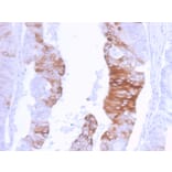 Immunohistochemistry - Anti-Cytokeratin 20 Antibody [KRT20/3129R] (A249674) - Antibodies.com