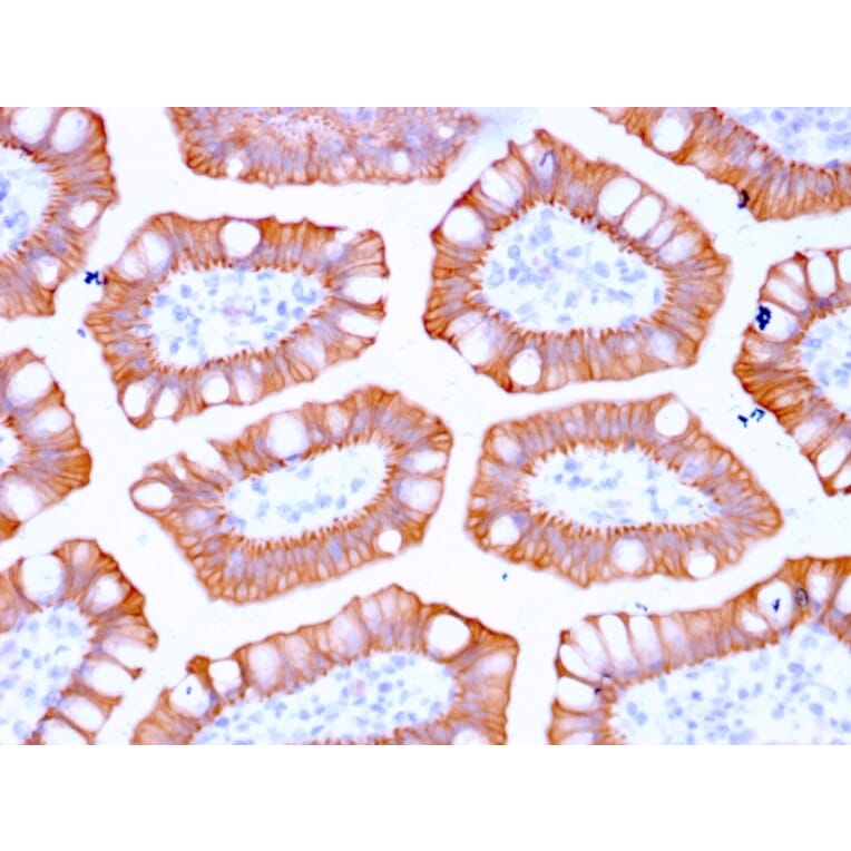 Immunohistochemistry - Anti-Cytokeratin 20 Antibody [KRT20/3129R] (A249675) - Antibodies.com