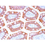 Immunohistochemistry - Anti-Cytokeratin 20 Antibody [KRT20/3129R] (A249675) - Antibodies.com