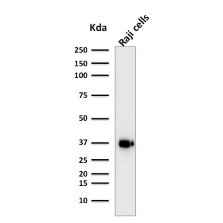 Western Blot - Anti-BOB1 Antibody [BOB1/2421] (A249676) - Antibodies.com