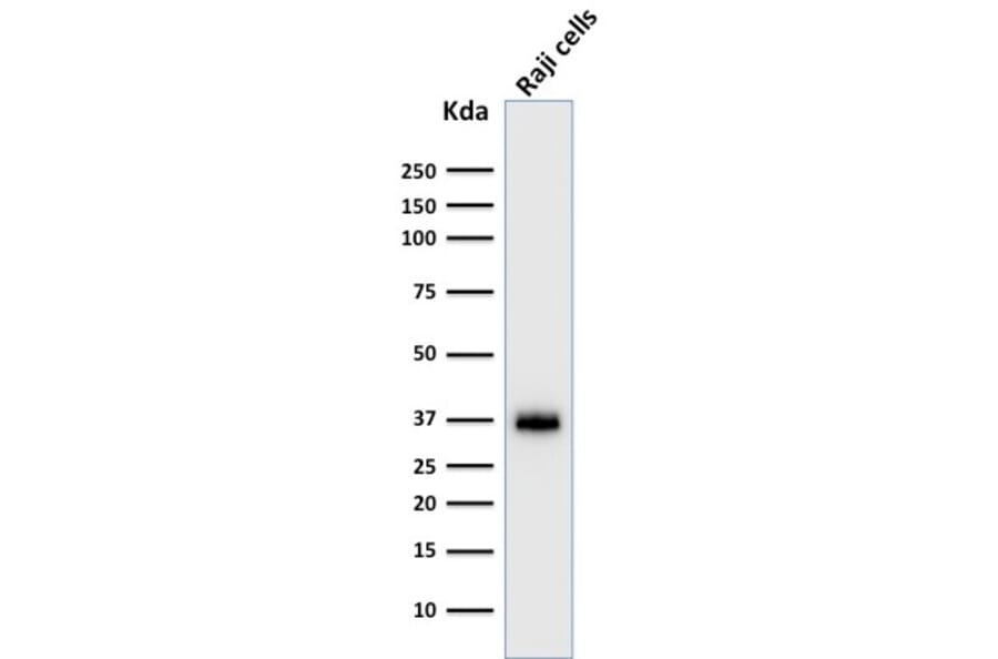 Western Blot - Anti-BOB1 Antibody [BOB1/2422] (A249677) - Antibodies.com