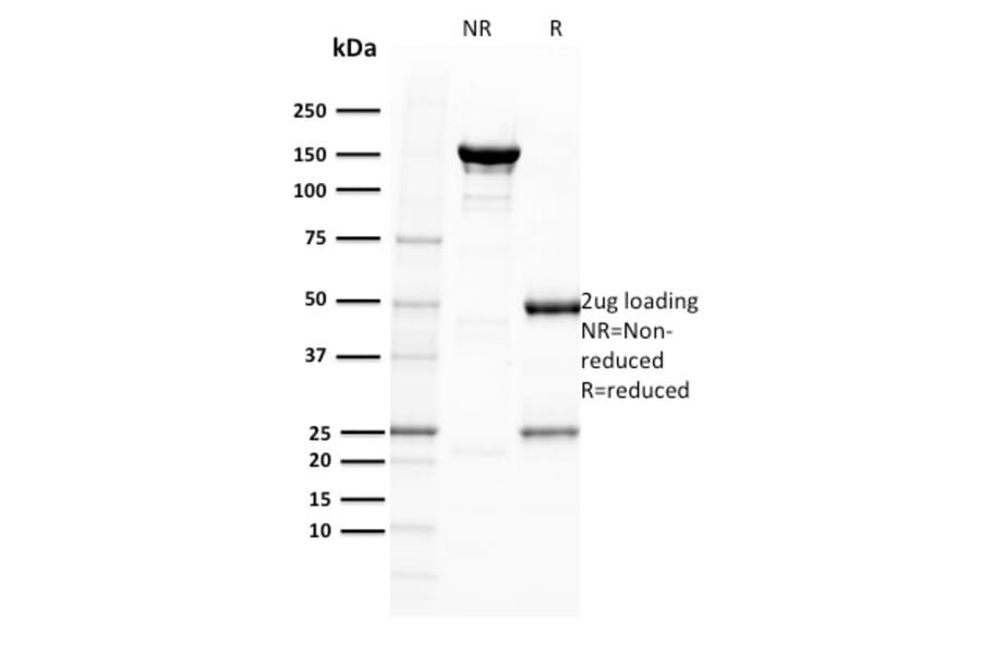 SDS-PAGE - Anti-BOB1 Antibody [BOB1/2422] (A249677) - Antibodies.com