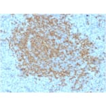 Immunohistochemistry - Anti-BOB1 Antibody [BOB1/2423] (A249678) - Antibodies.com