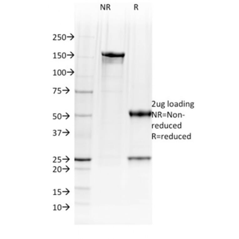 SDS-PAGE - Anti-BOB1 Antibody [BOB1/2423] (A249678) - Antibodies.com