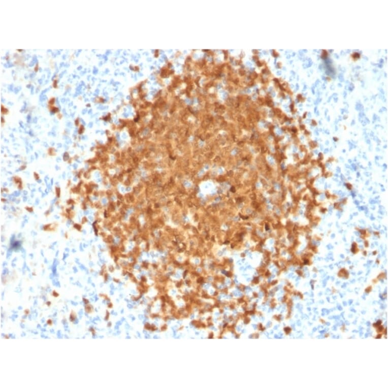 Immunohistochemistry - Anti-BOB1 Antibody [BOB1/2424] (A249679) - Antibodies.com
