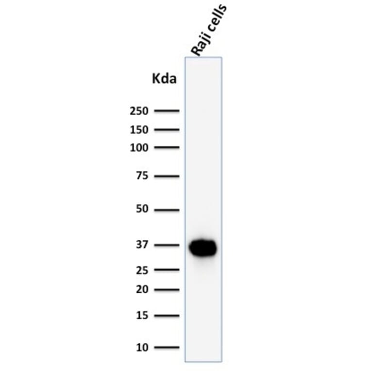 Western Blot - Anti-BOB1 Antibody [BOB1/2425] (A249680) - Antibodies.com