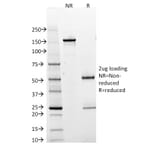 SDS-PAGE - Anti-BOB1 Antibody [BOB1/2425] (A249680) - Antibodies.com