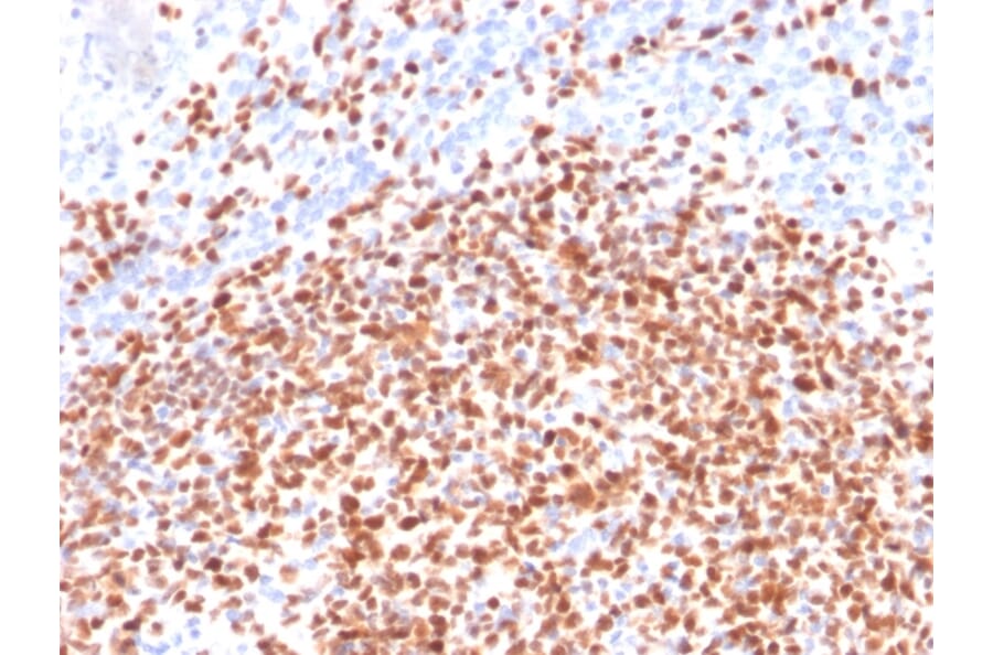 Immunohistochemistry - Anti-OCT-2 Antibody [Oct2/2137] (A249682) - Antibodies.com