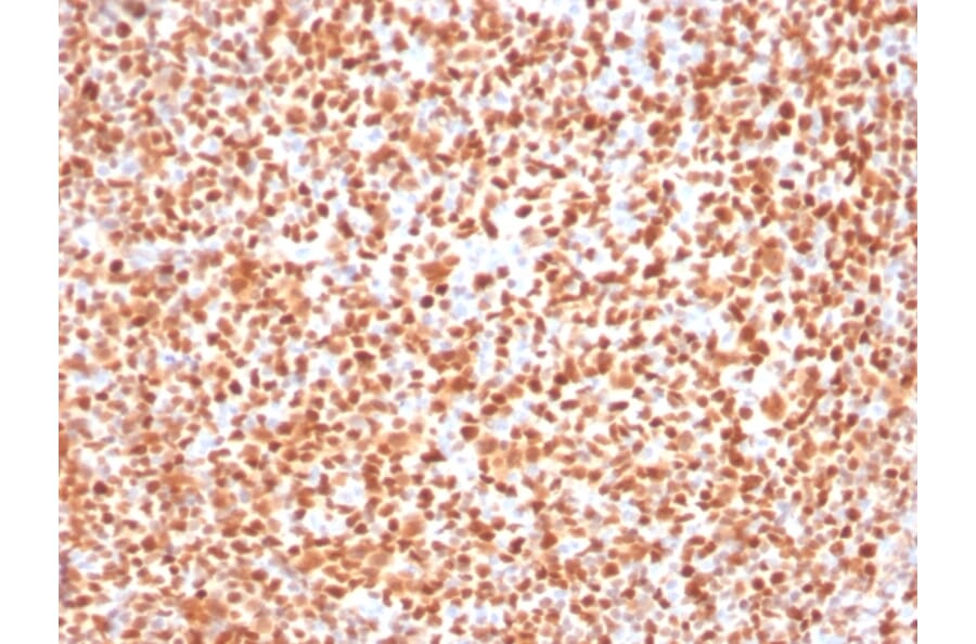 Immunohistochemistry - Anti-OCT-2 Antibody [Oct2/2137] (A249682) - Antibodies.com