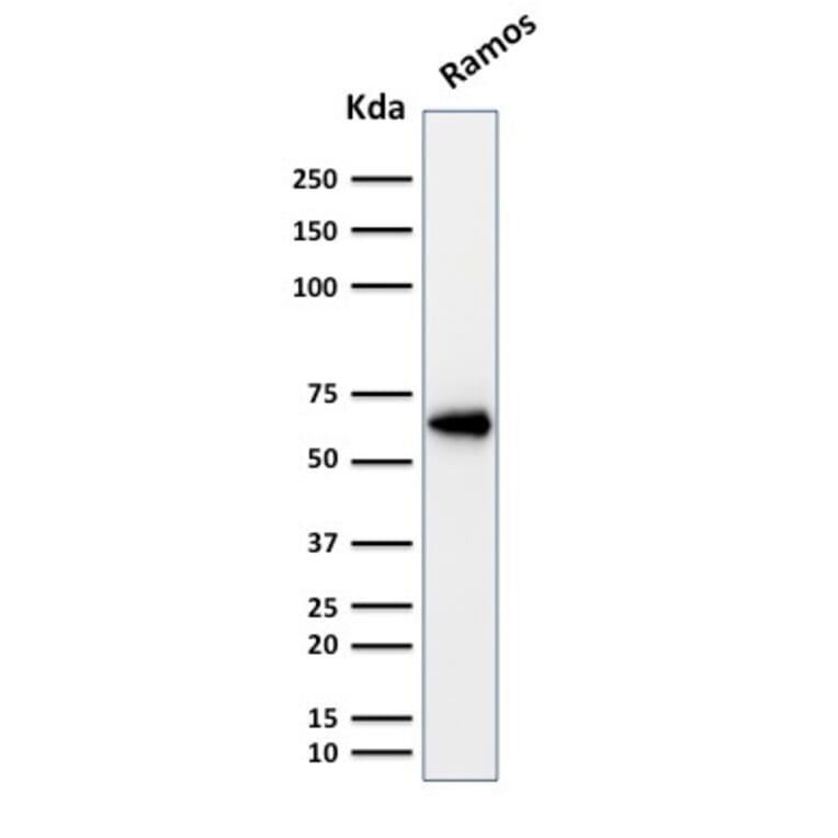 Western Blot - Anti-OCT-2 Antibody [Oct2/2137] (A249682) - Antibodies.com