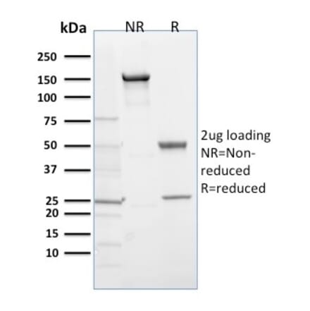 SDS-PAGE - Anti-PHD2 Antibody [366G/76/3] (A249682) - Antibodies.com