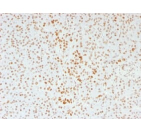 Immunohistochemistry - Anti-ATRX Antibody [39f] (A249683) - Antibodies.com