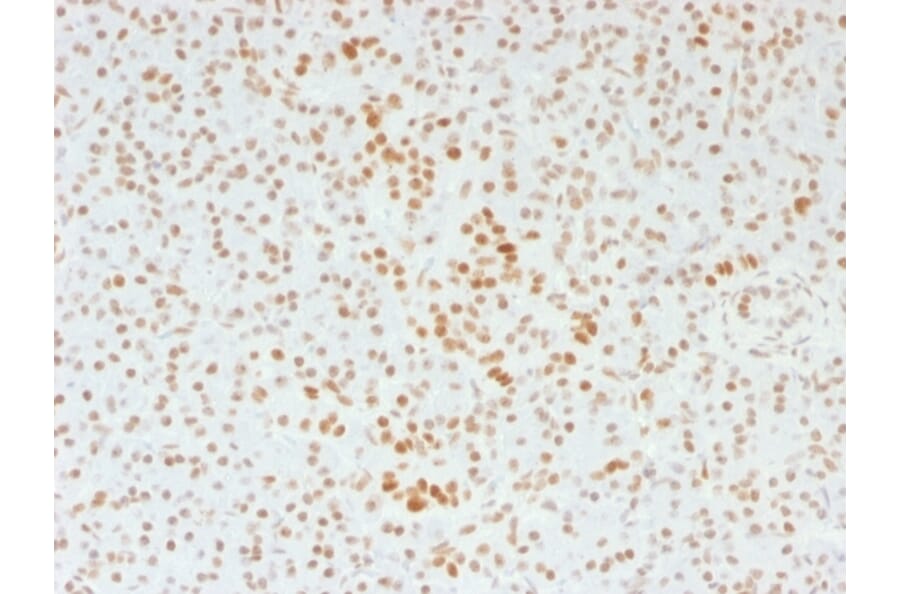 Immunohistochemistry - Anti-ATRX Antibody [39f] (A249683) - Antibodies.com