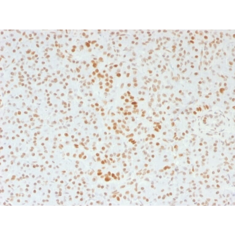 Immunohistochemistry - Anti-ATRX Antibody [39f] (A249683) - Antibodies.com