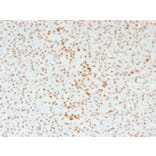 Immunohistochemistry - Anti-ATRX Antibody [39f] (A249683) - Antibodies.com