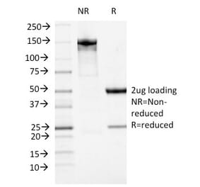 SDS-PAGE - Anti-ATRX Antibody [23c] (A249684) - Antibodies.com