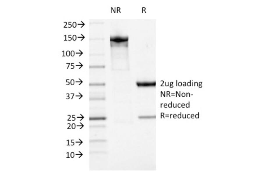 SDS-PAGE - Anti-ATRX Antibody [23c] (A249684) - Antibodies.com