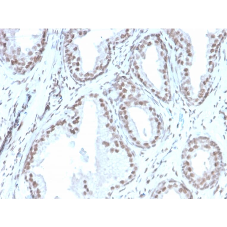 Immunohistochemistry - Anti-ATRX Antibody [rATRX/3446] (A249685) - Antibodies.com