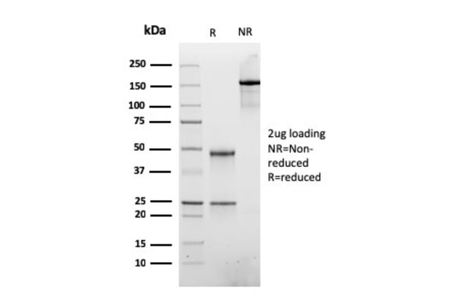 SDS-PAGE - Anti-ATRX Antibody [rATRX/3446] (A249686) - Antibodies.com