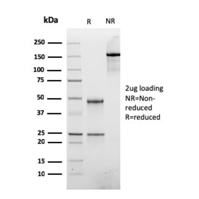 SDS-PAGE - Anti-ATRX Antibody [rATRX/3446] (A249686) - Antibodies.com