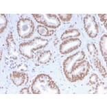 Immunohistochemistry - Anti-ATRX Antibody [ATRX/2900R] (A249686) - Antibodies.com