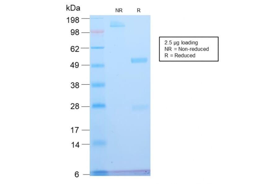 SDS-PAGE - Anti-ATRX Antibody [ATRX/2900R] (A249687) - Antibodies.com