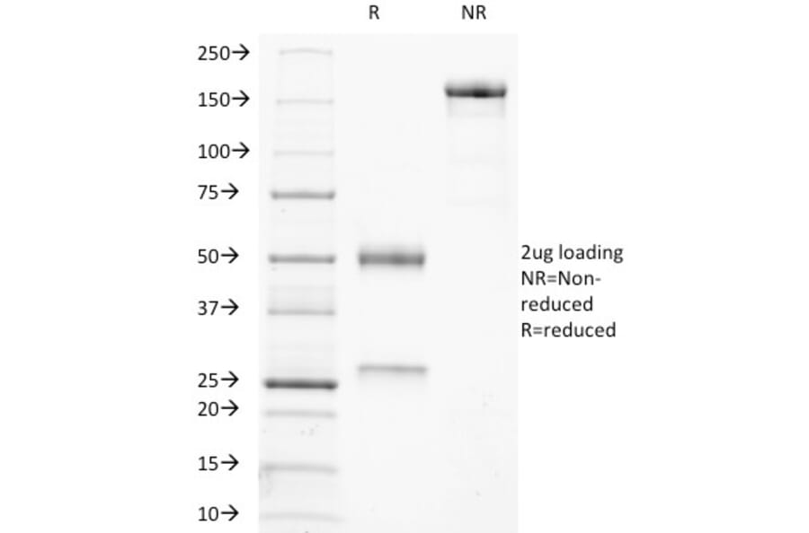 SDS-PAGE - Anti-Tartrate Resistant Acid Phosphatase Antibody [ACP5/1070] (A249688) - Antibodies.com