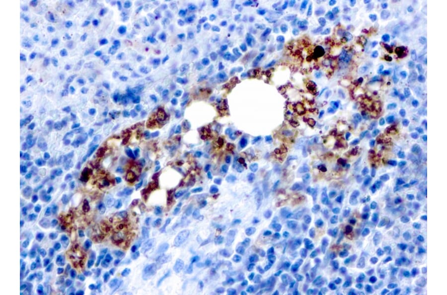 Immunohistochemistry - Anti-Tartrate Resistant Acid Phosphatase Antibody [rACP5/1070] (A249690) - Antibodies.com