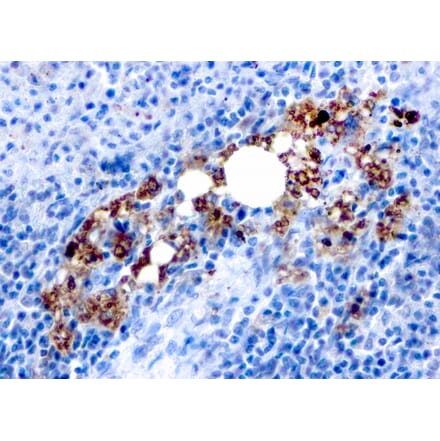 Immunohistochemistry - Anti-Tartrate Resistant Acid Phosphatase Antibody [rACP5/1070] (A249690) - Antibodies.com