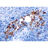 Immunohistochemistry - Anti-Tartrate Resistant Acid Phosphatase Antibody [rACP5/1070] (A249690) - Antibodies.com