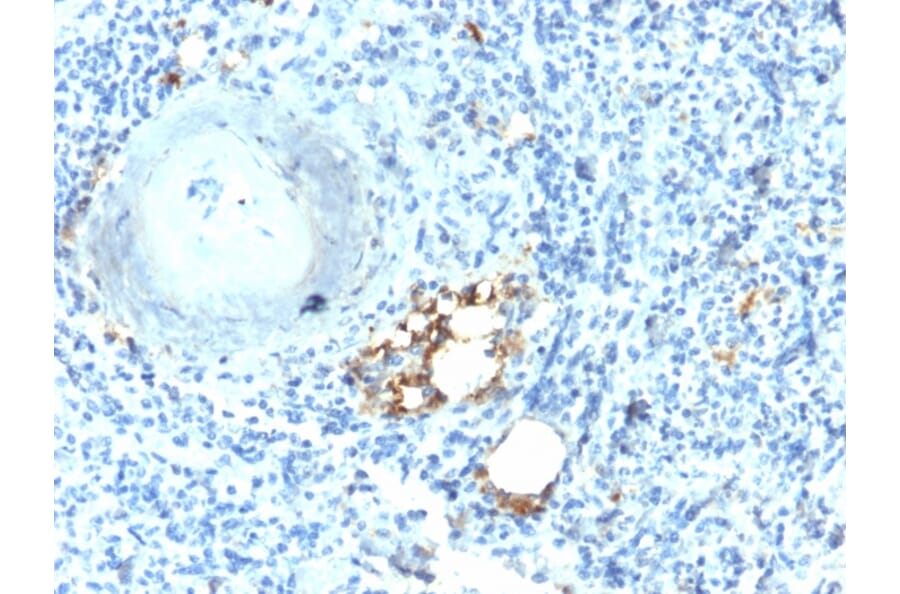 Immunohistochemistry - Anti-Tartrate Resistant Acid Phosphatase Antibody [ACP5/2336R] (A249690) - Antibodies.com