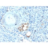 Immunohistochemistry - Anti-Tartrate Resistant Acid Phosphatase Antibody [ACP5/2336R] (A249690) - Antibodies.com