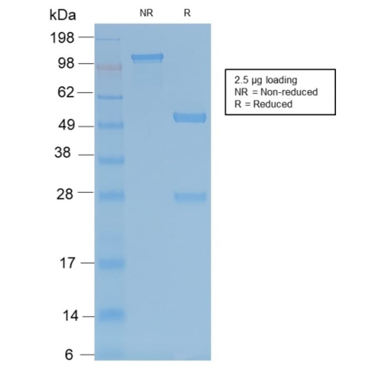 SDS-PAGE - Anti-Tartrate Resistant Acid Phosphatase Antibody [ACP5/2336R] (A249691) - Antibodies.com