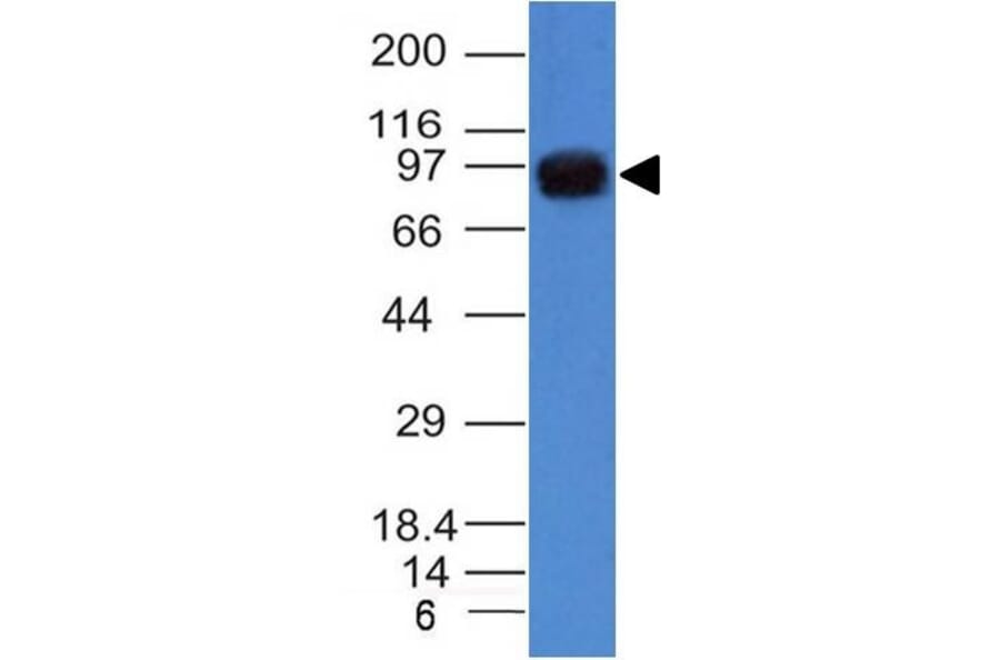 Western Blot - Anti-UACA Antibody [UACA/1222] (A249692) - Antibodies.com