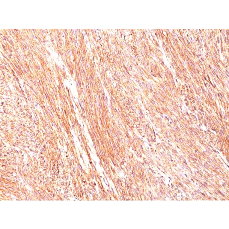 Immunohistochemistry - Anti-TMEM16A Antibody [DG1/447] (A249693) - Antibodies.com