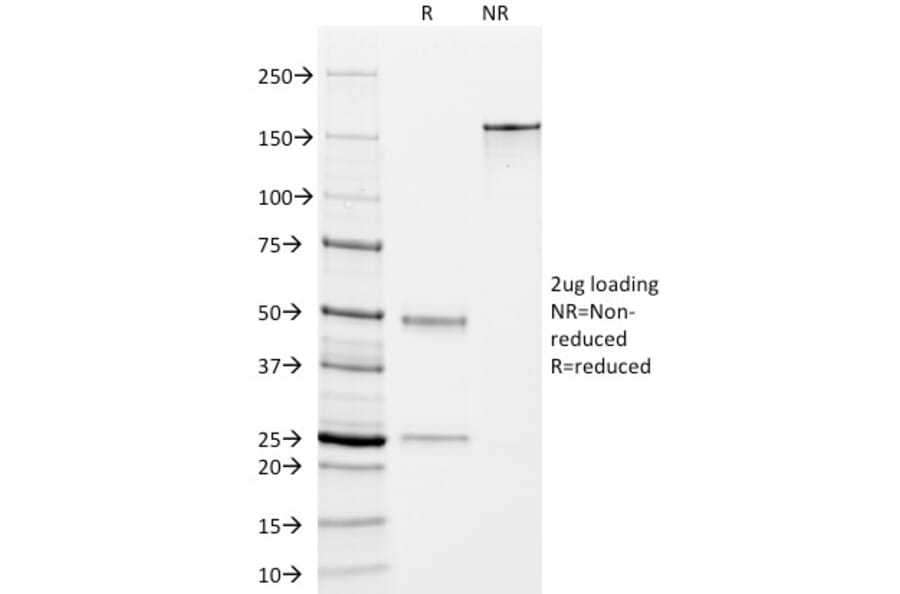 SDS-PAGE - Anti-TMEM16A Antibody [DG1/447] (A249694) - Antibodies.com
