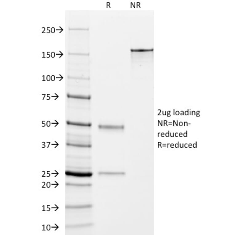 SDS-PAGE - Anti-TMEM16A Antibody [DG1/447] (A249694) - Antibodies.com