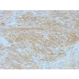 Immunohistochemistry - Anti-TMEM16A Antibody [SPM580] (A249694) - Antibodies.com