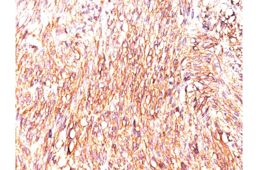 Immunohistochemistry - Anti-TMEM16A Antibody [DOG-1.1] (A249695) - Antibodies.com
