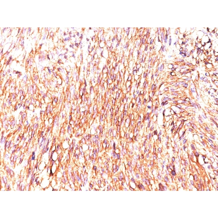 Immunohistochemistry - Anti-TMEM16A Antibody [DOG-1.1] (A249695) - Antibodies.com