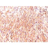 Immunohistochemistry - Anti-TMEM16A Antibody [DOG-1.1] (A249695) - Antibodies.com