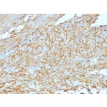 Immunohistochemistry - Anti-TMEM16A Antibody [DG1/447 + DOG-1.1] (A249696) - Antibodies.com