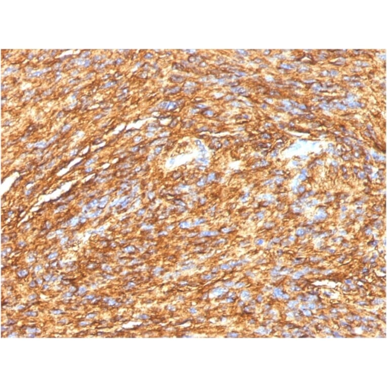 Immunohistochemistry - Anti-TMEM16A Antibody [DG1/1484] (A249698) - Antibodies.com