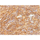 Immunohistochemistry - Anti-TMEM16A Antibody [DG1/1484] (A249698) - Antibodies.com