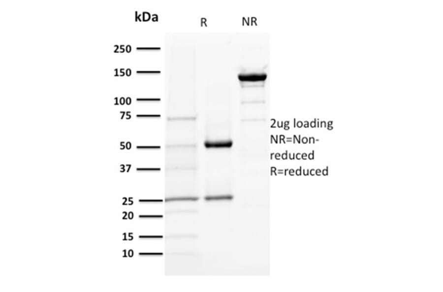 SDS-PAGE - Anti-TMEM16A Antibody [DG1/1484] (A249698) - Antibodies.com
